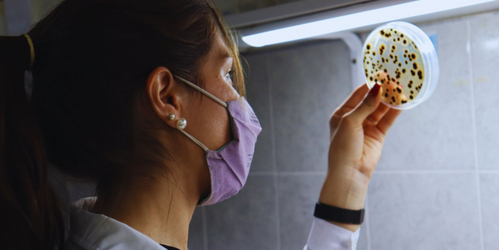 Banano en Argentina: INTA investiga el control biológico para combatir la Sigatoka