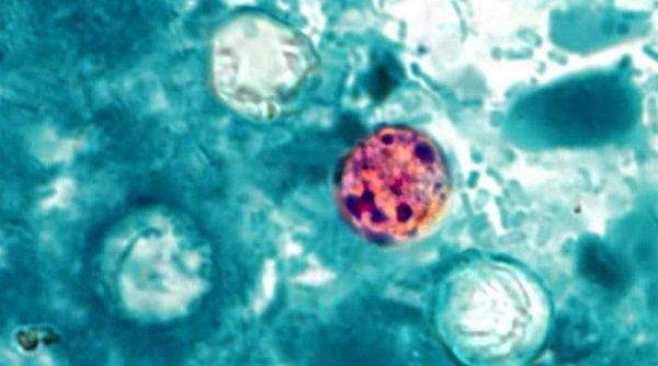 Taylor Farms suspenderá envíos de lechuga mexicana debido a brote de ciclosporiasis 3 Cyclosporiasis